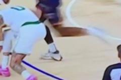 美國醫(yī)學專家：可以看到右小腿有震動 這可能是跟腱撕裂的跡象